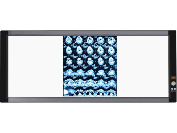 山東眾佳ZJ-G3B 系列LED醫用超薄液晶觀片燈