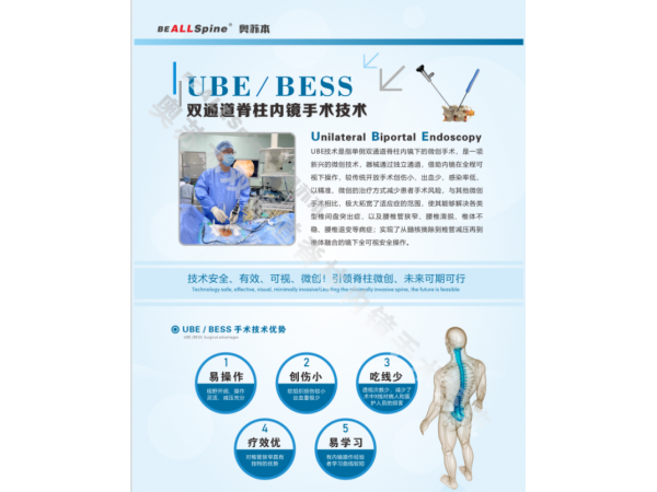 山東奧蘇本UBE雙通道脊柱內鏡微創手術系統的技術