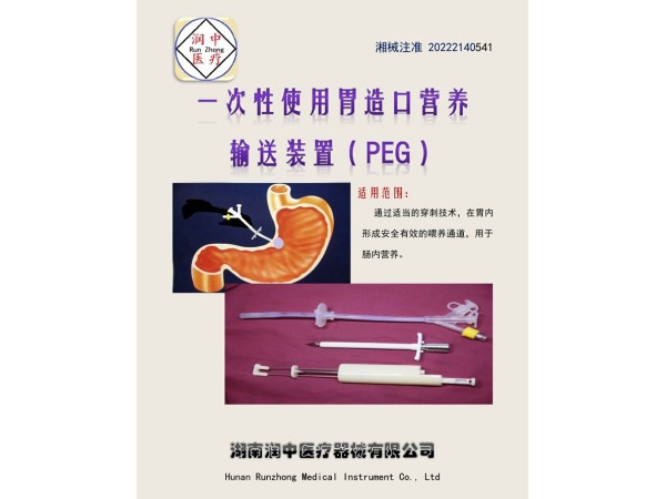 經皮胃造瘺飼管（一次性使用胃造口營養輸送裝置(PEG)）